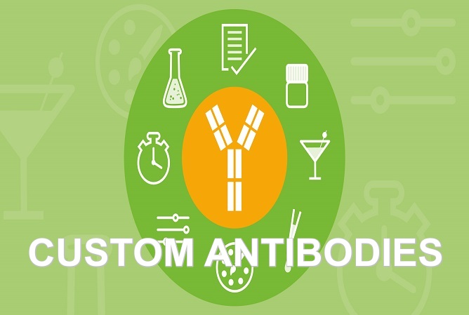 Looking For Custom Antibody Production Services? Click Here!